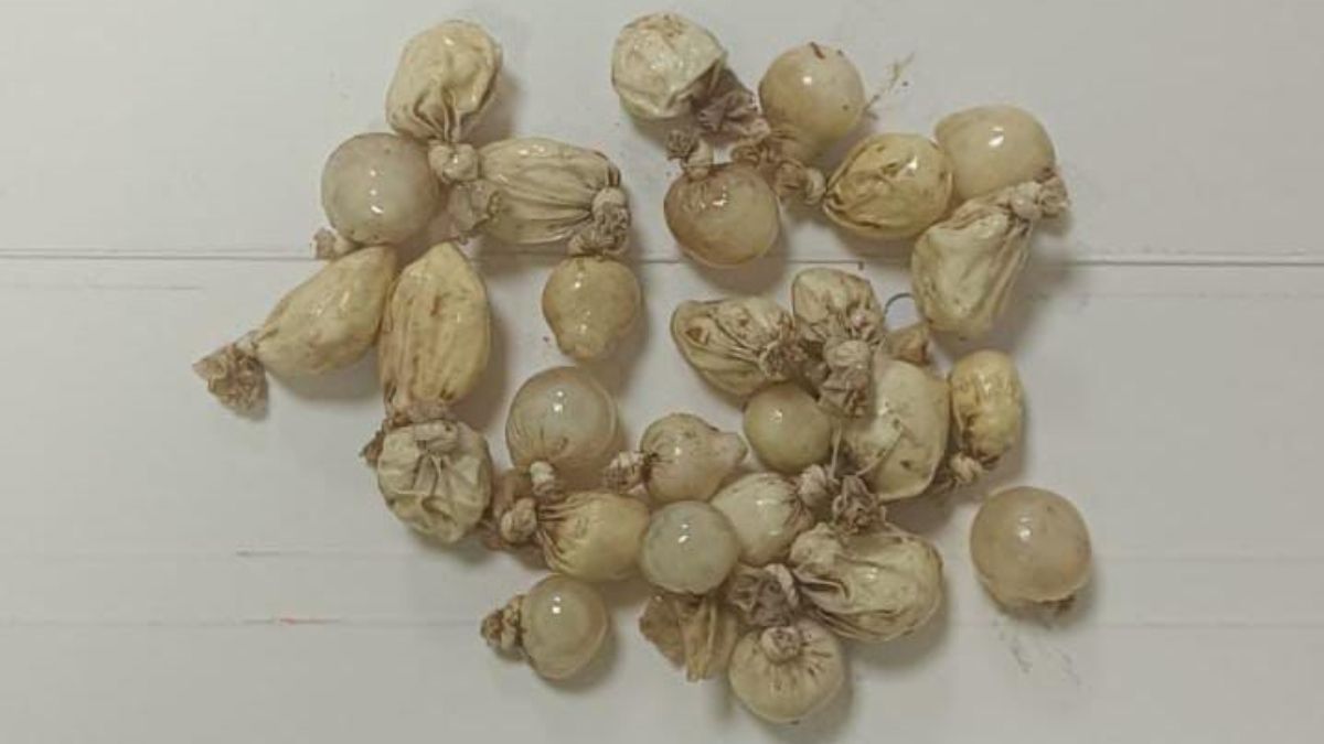 Kocaeli’de alkollü sanılan sürücünün midesinden kokain çıktı