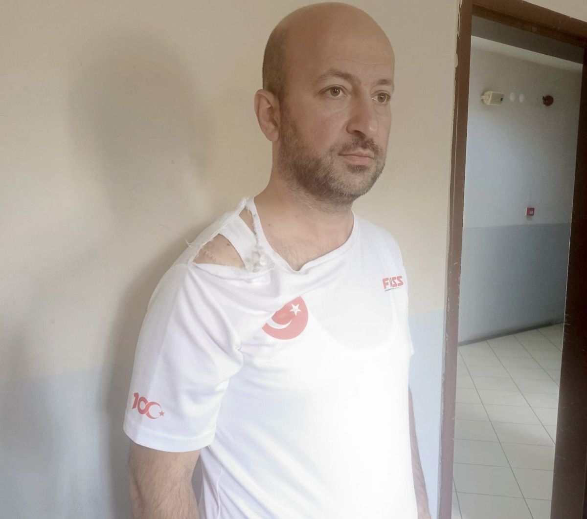 Ankara’da 6 yaşındaki oğlu için velayet davası açtı: Kadınların sopalı saldırısına uğradı