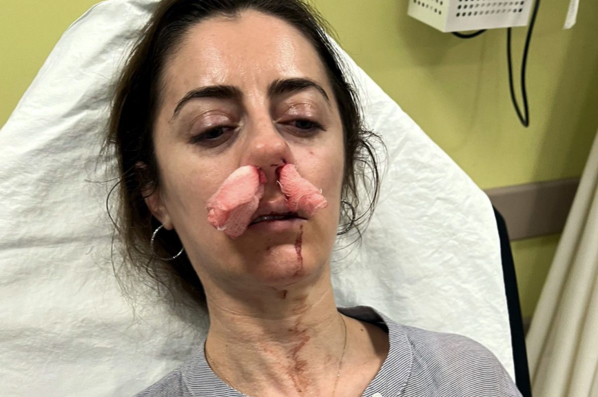 Edirne’de eşinin sevgilisi sandığı kadını darbettiği otomobil kapısı ‘silah’ sayıldı