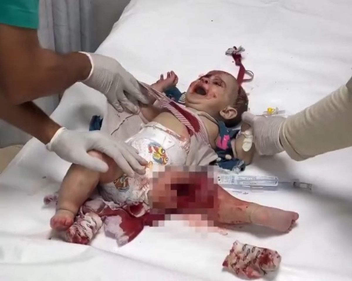 İsrail, Gazze’de bebekleri hedef alıyor