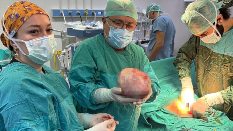 Amasya’da kadının şişen karnından 6 kiloluk kitle çıktı