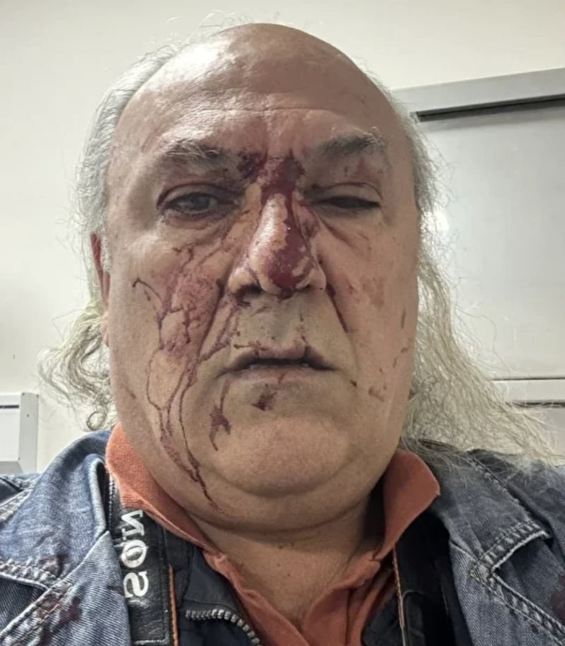 CHP’li Ayvalık Belediyesi’nin korumalarından gazeteci Yüksel Kalkan’a darp